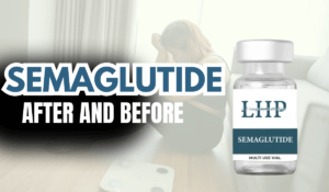 Semaglutide Weight Loss